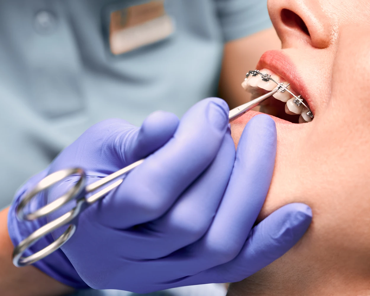 brackets